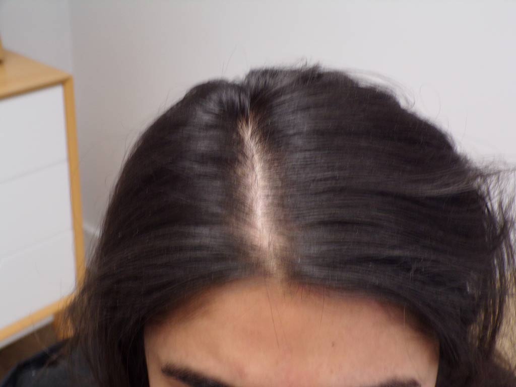 At 3 months