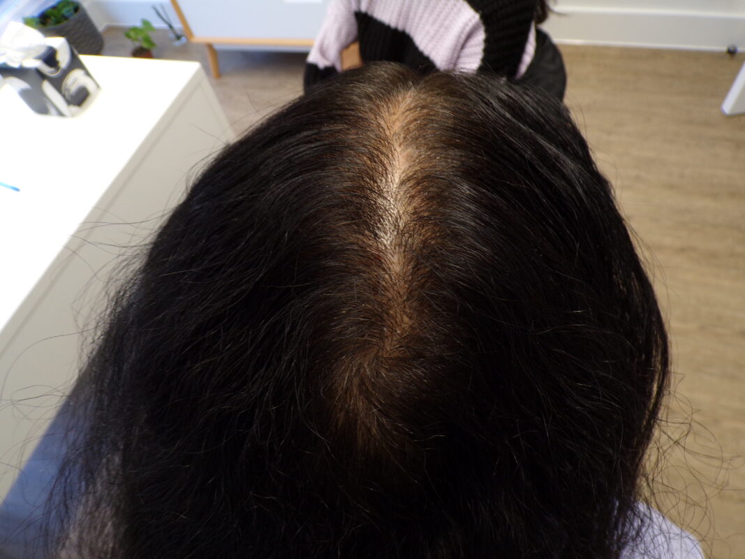 At 4 months, rear
