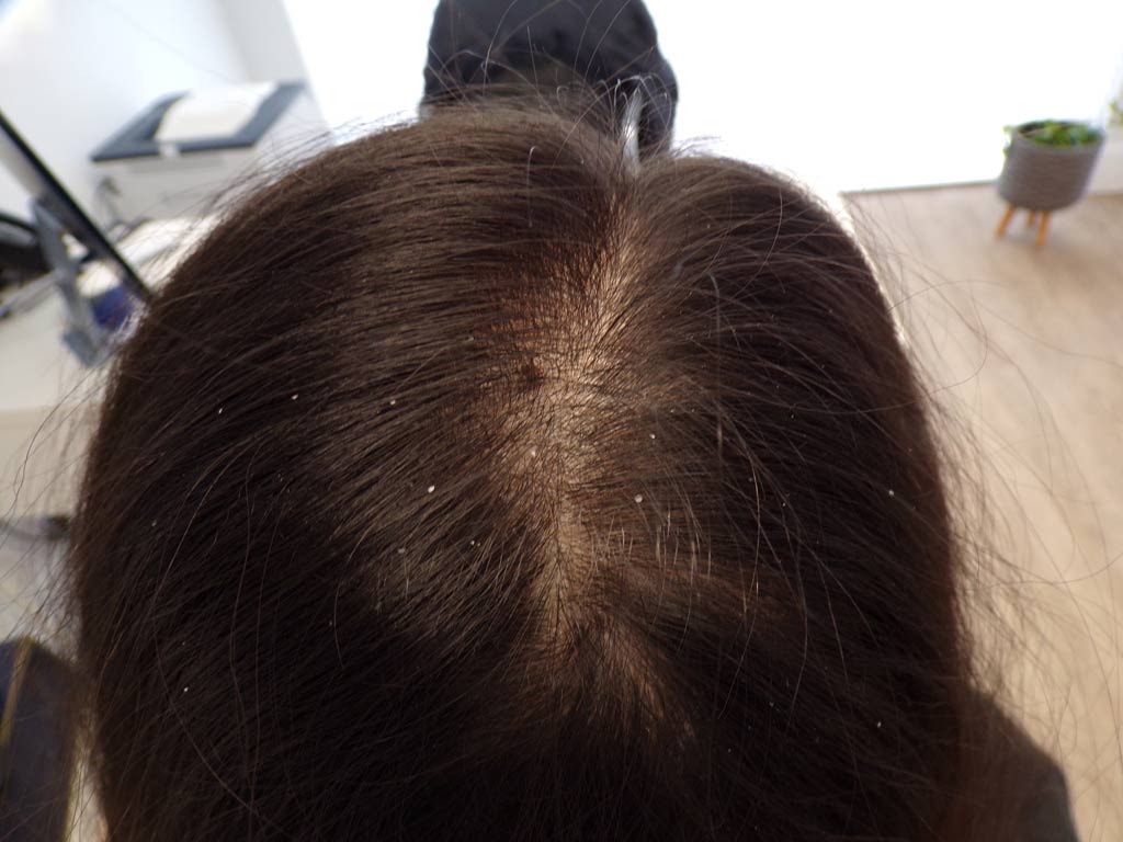 After 6 months - from rear