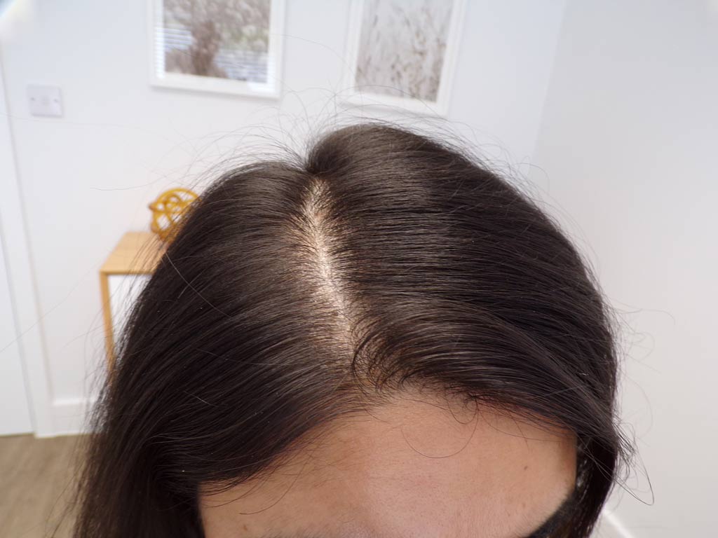 At 6 months