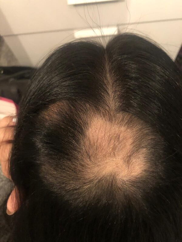 At 3 months
