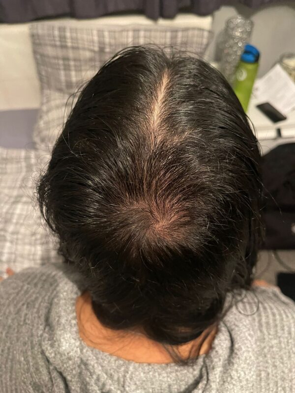 At 5 months