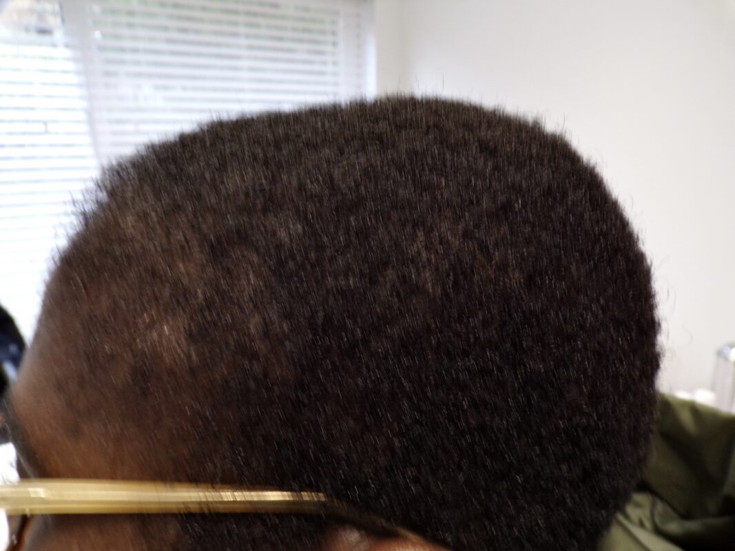 4 months into treatment
