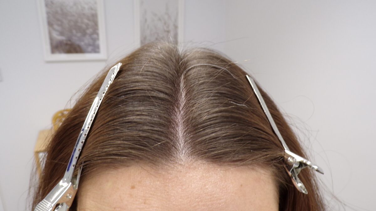 4 months into treatment