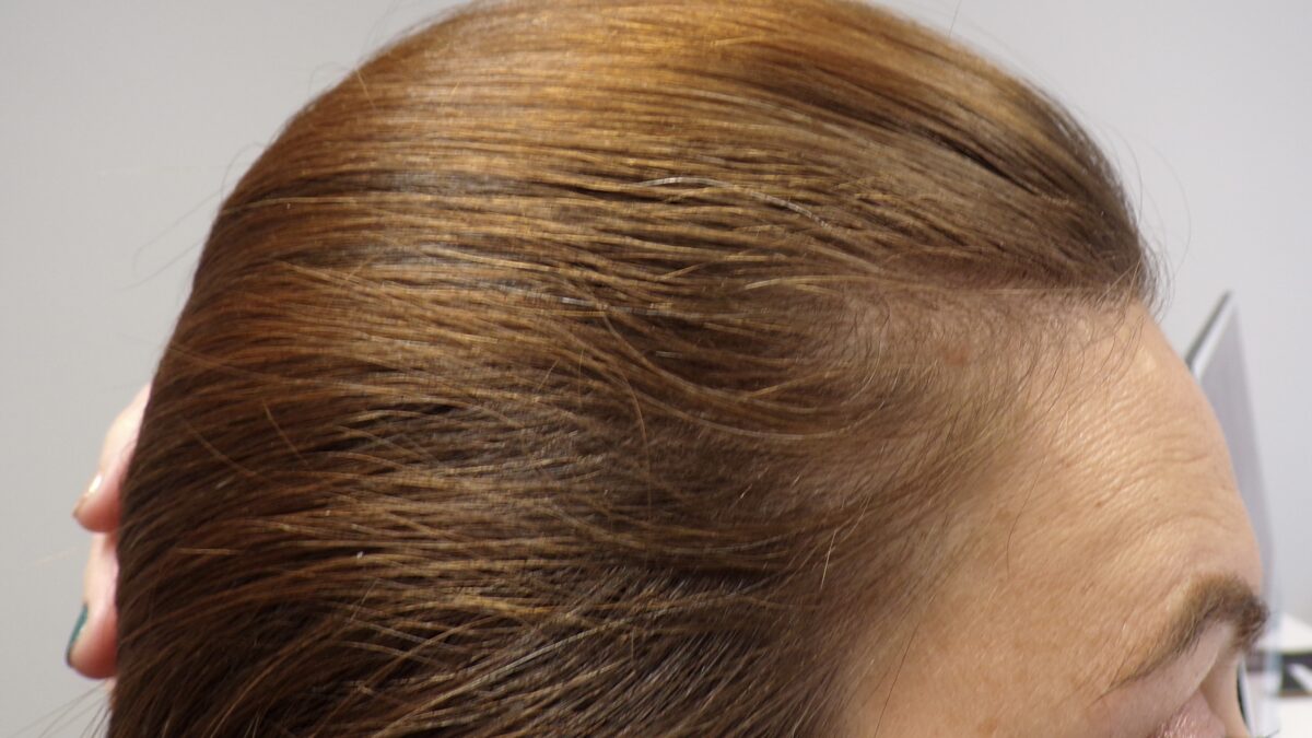 At 4 months into treatment
