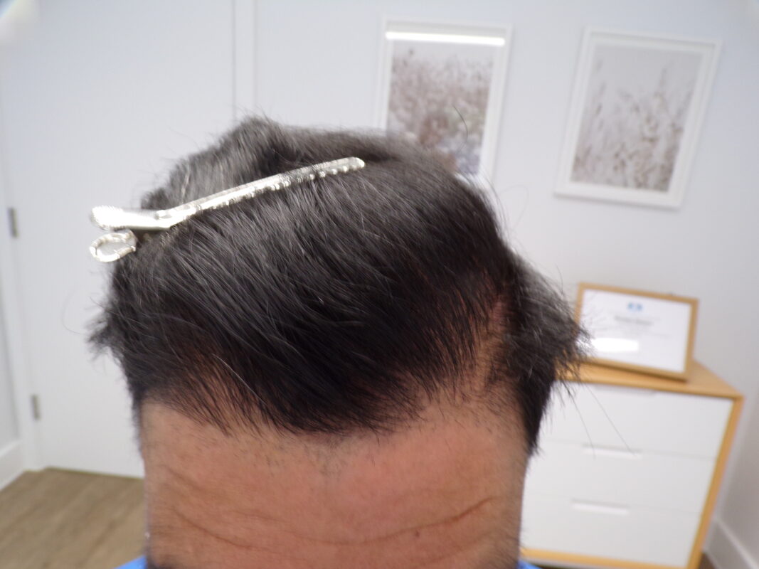 After 8 months of treatment