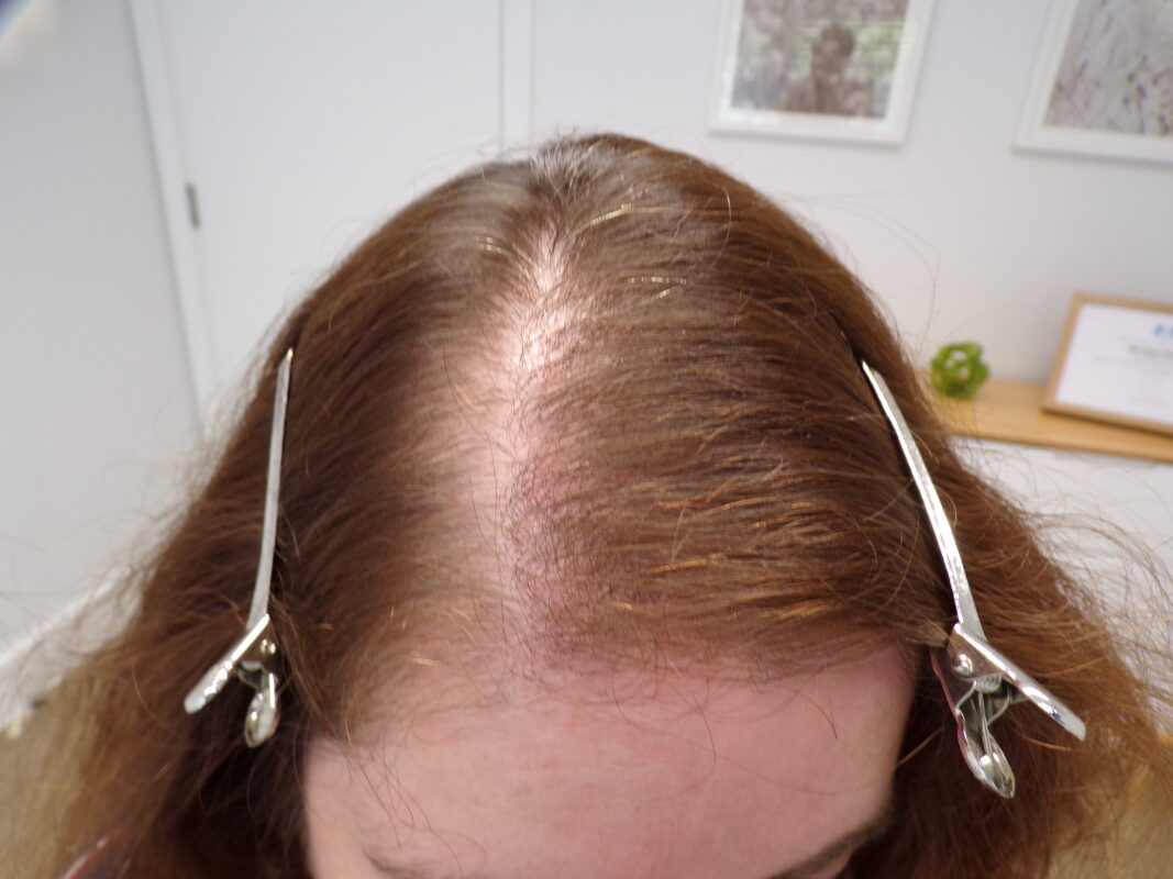 Hair before treatment