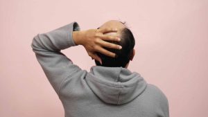 Hair loss treatment for men
