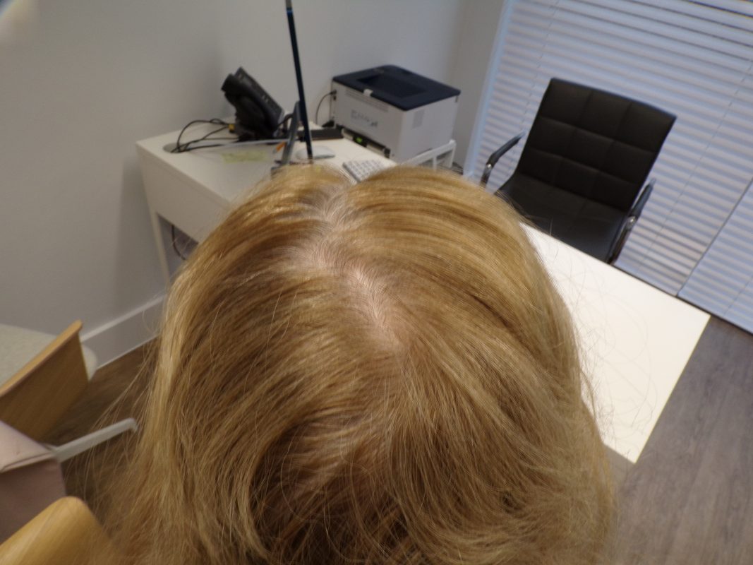 At 7 months of treatment