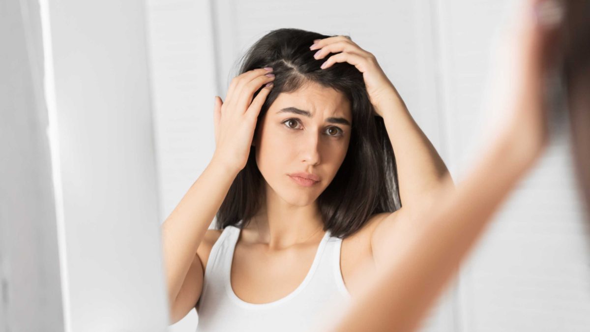 Female Pattern Baldness