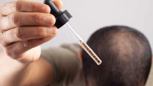 Hair thinning solutions for male