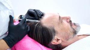 Non-surgical hair restoration