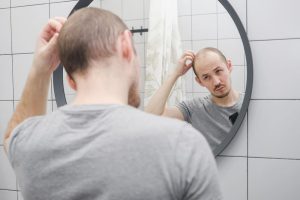 Expert help for genetic and hormonal hair loss