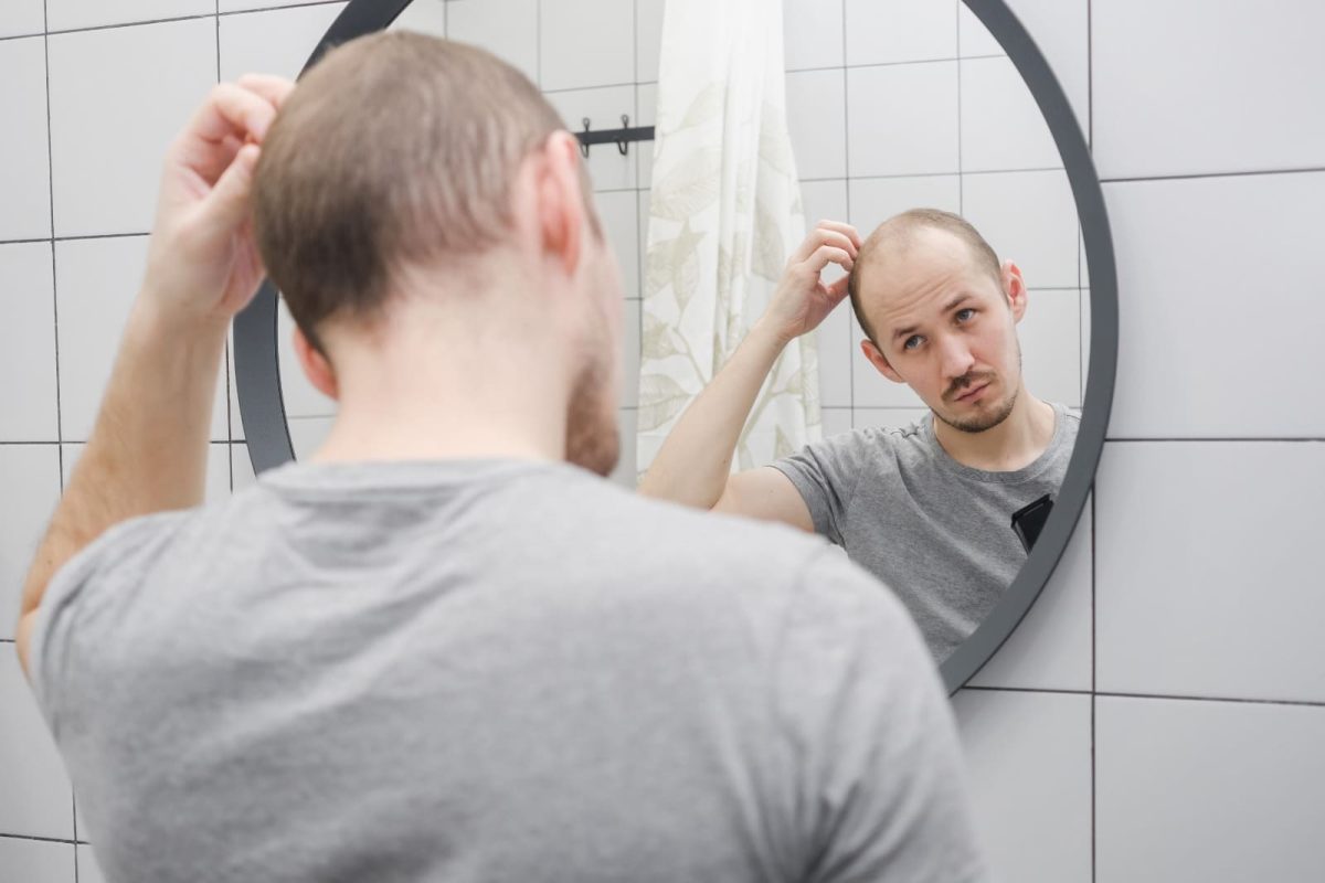 Expert help for genetic and hormonal hair loss