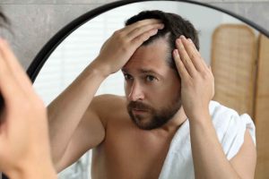 Treating early hair loss in men confidently
